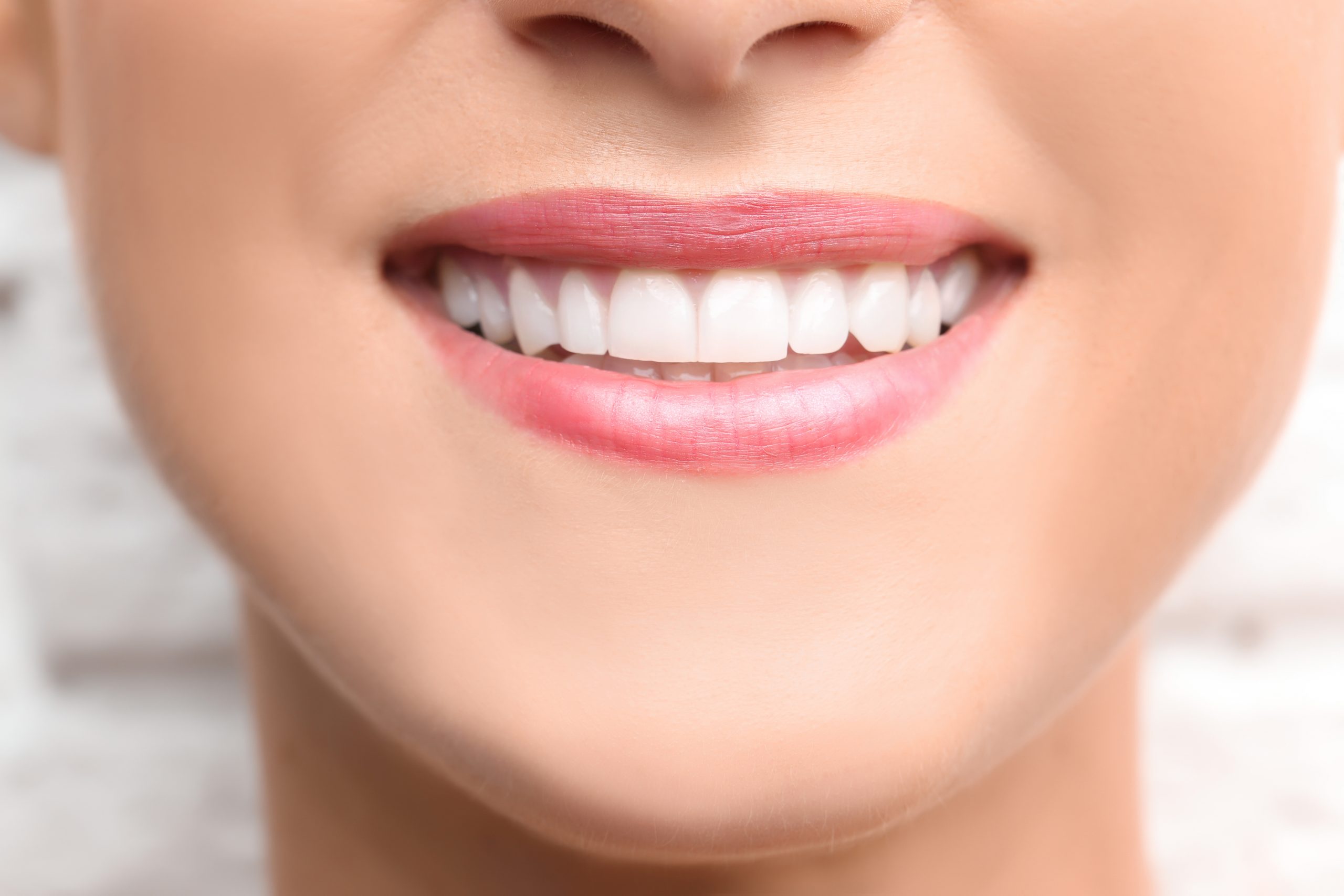 Patient smiling after professional teeth whitening consultation at Contemporary Dental Concepts in Tempe, Arizona