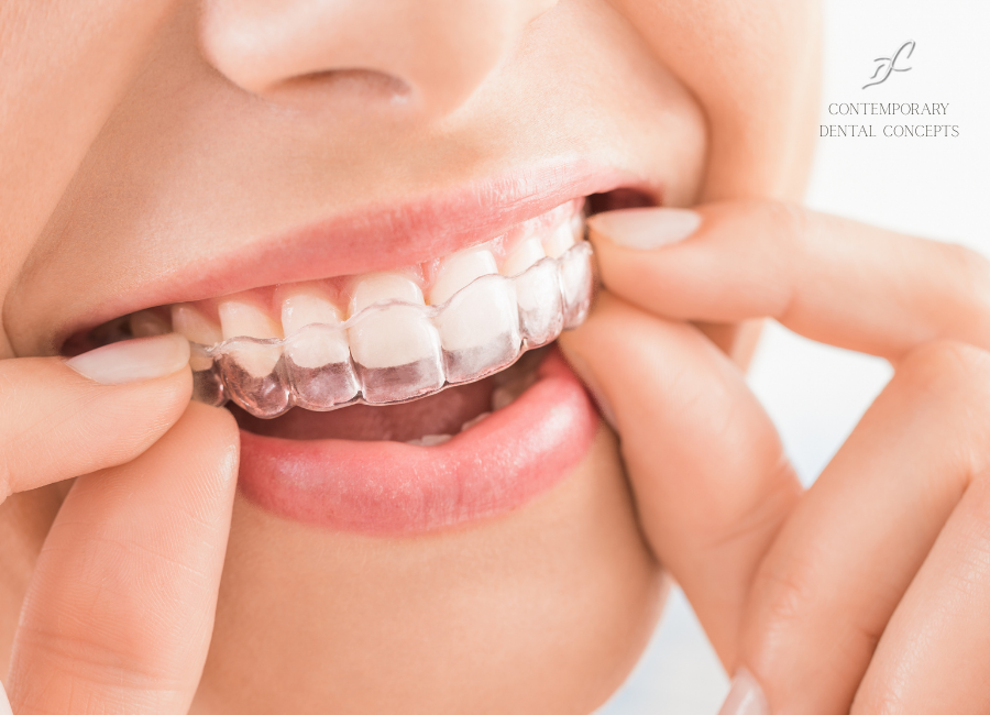 Patient with clear SureSmile aligners at Contemporary Dental Concepts in Tempe, AZ