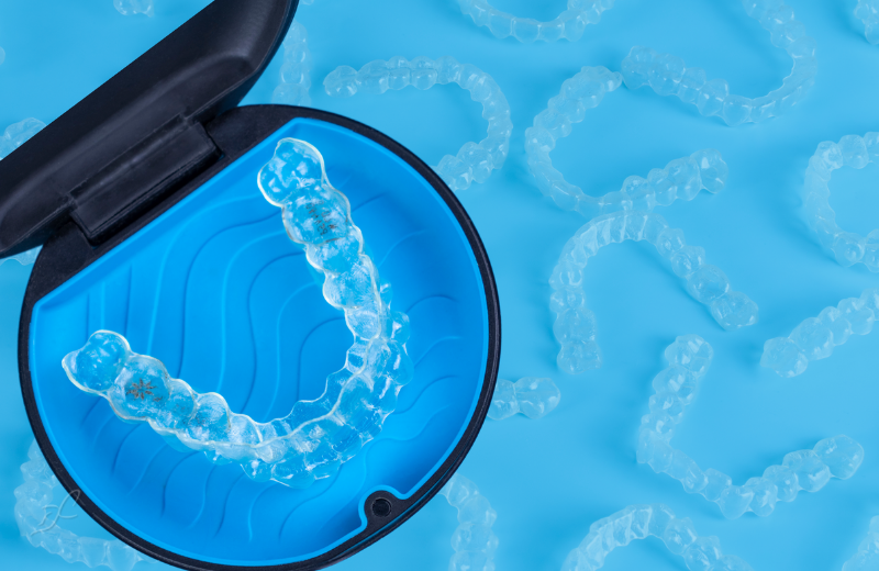 Custom SureSmile aligners close-up